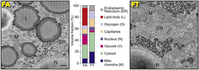 Time-Restricted Feeding Prevents Liver Diseases