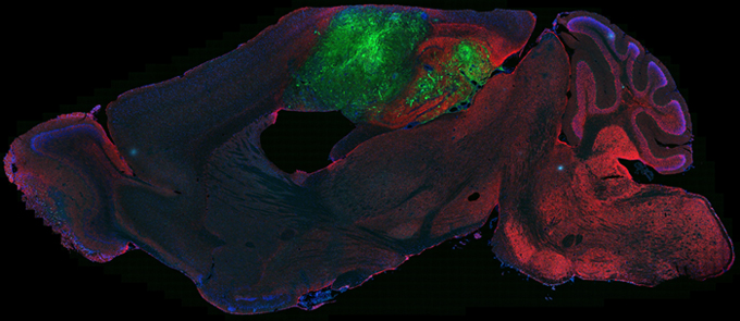 Origin of Glioblastomas
